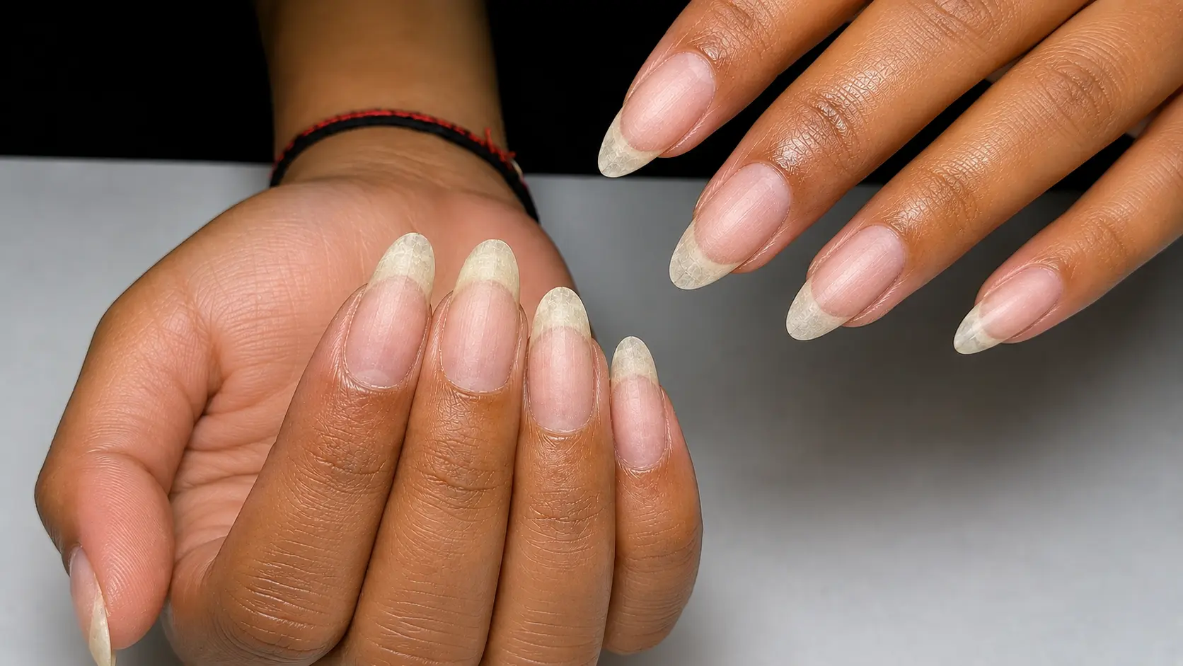 Nails Before Transformation
